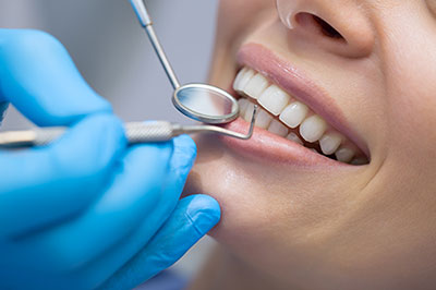 Terry Soule, DDS | Teeth Whitening, Botox reg  and Oral Exams