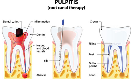 Terry Soule, DDS | Veneers, Botox reg  and TMJ Disorders